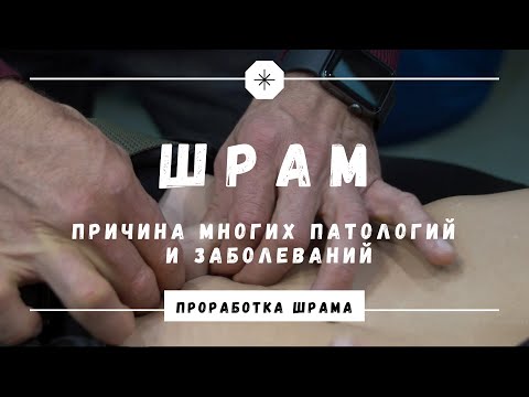 Lenin, pshelvon - Шрамы на теле видео (клип)